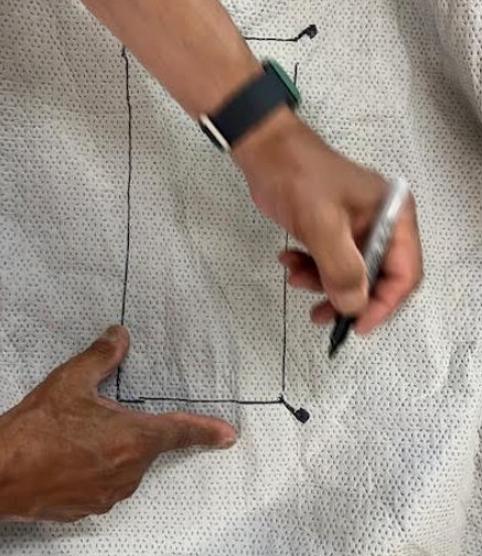 Making diagonal corner cuts in fabric opening for Viraport tab insertion
